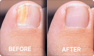 Before and after results